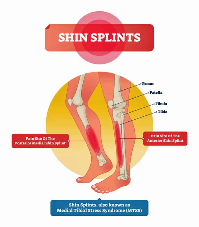 Pain At Top Of Shin Bone Below Knee At Lisa Tucker Blog