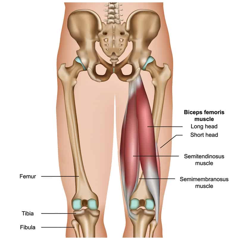 chronic-hamstring-injuries-when-sprinting-how-to-stay-fit